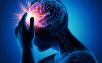 Epilessia