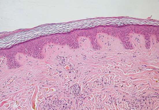 Epidermide e derma - La pelle che riveste il corpo umano