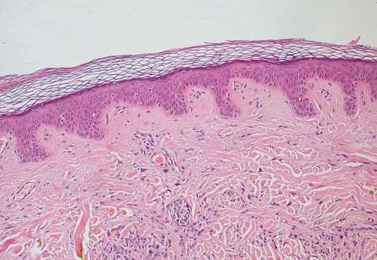 Epidermide e derma - La pelle che riveste il corpo umano