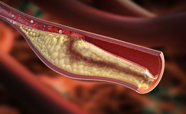 Colesterolo HDL e LDL