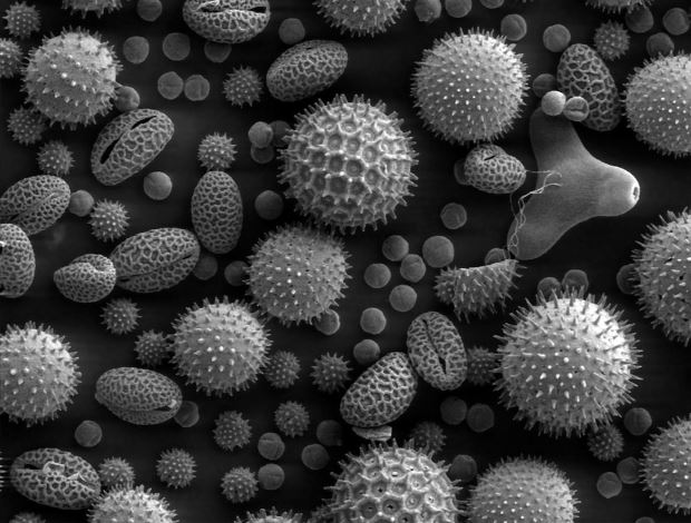 Anatomia vegetale - Polline al microscopio